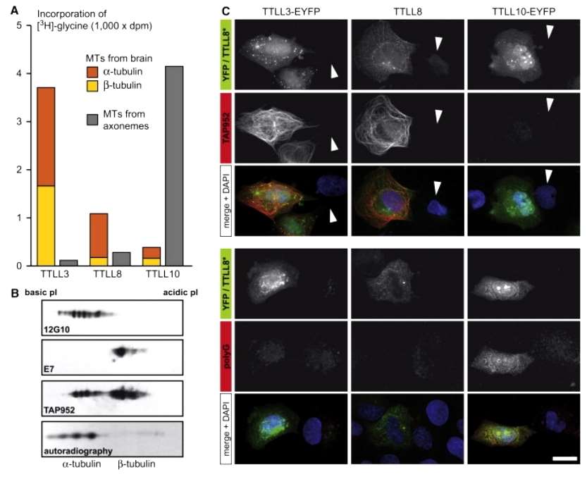 Advancements in Protein Methylation Research